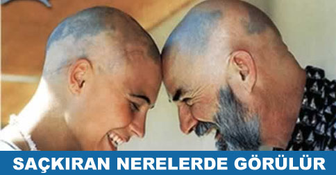 saçkıran nerelerde görülür