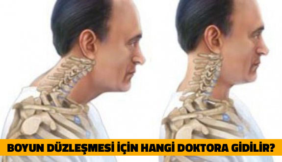 Boyun Düzleşmesi İçin Hangi Doktora Gidilir?