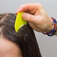 saç biti nasıl temizlenir