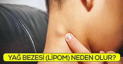 Lipom (Yağ Bezesi) Neden ve Nasıl Oluşur?